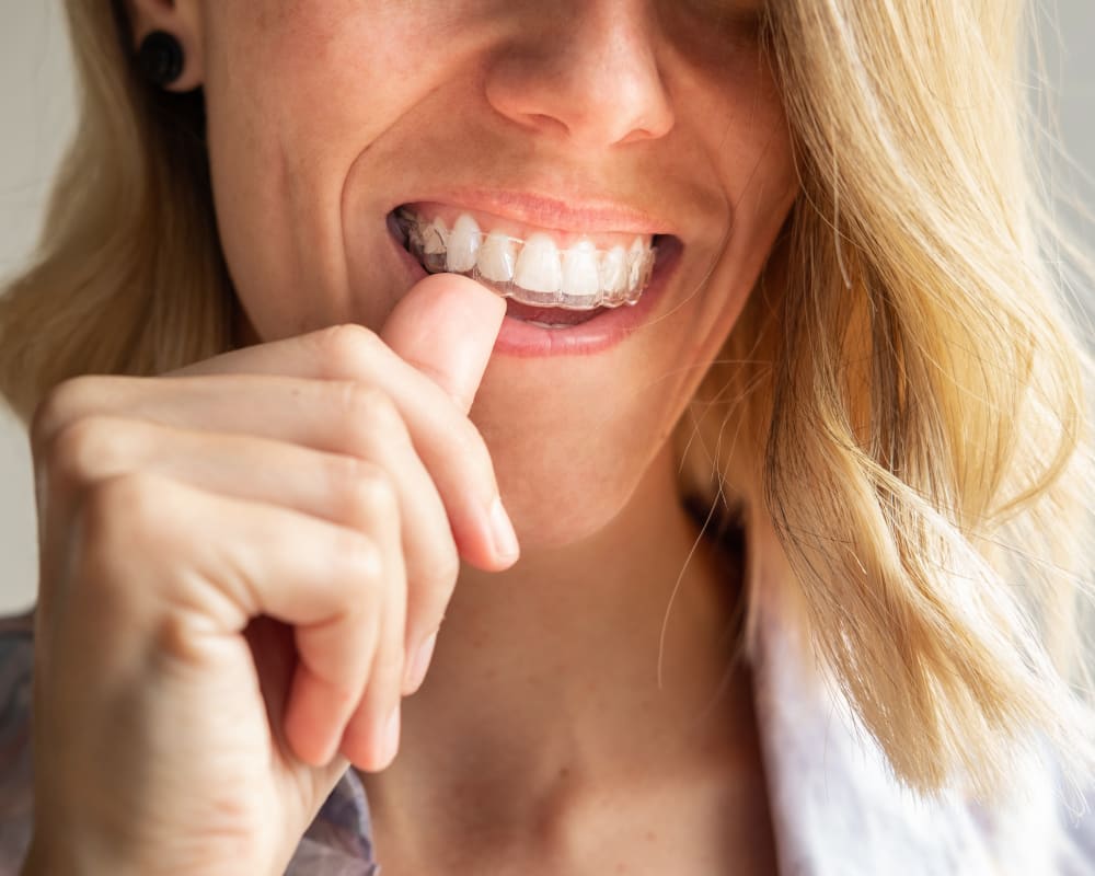 Invisalign in Aurora | Dawson Dental