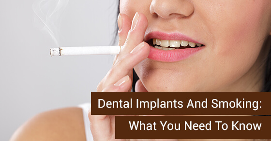 Dental Implants And Smoking