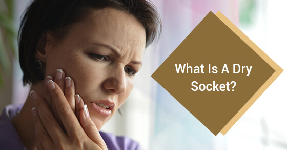 Dry Socket