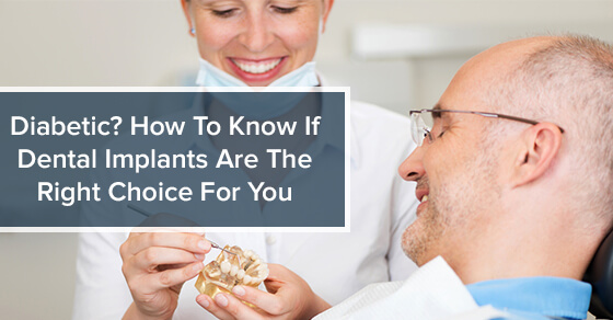 Diabetic? How To Know If Dental Implants Are The Right Choice For You