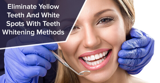 Eliminate Yellow Teeth And White Spots With Teeth Whitening Methods