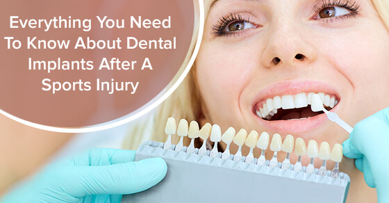 Everything You Need To Know About Dental Implants After A Sports Injury
