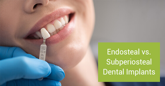 Endosteal vs. Subperiosteal Dental Implants