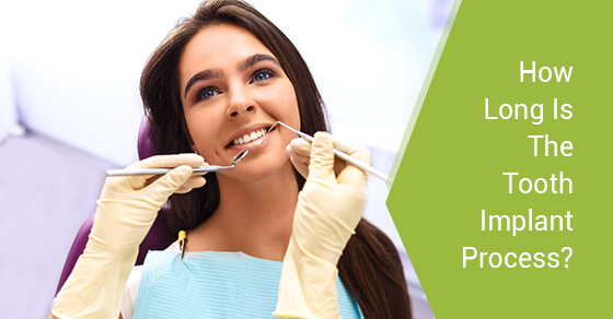 How Long Is The Tooth Implant Process