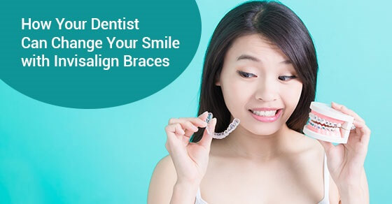 How Your Dentist Can Change Your Smile with Invisalign Braces