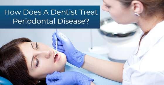 How Does A Dentist Treat Periodontal Disease Dawson Dental 