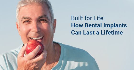 Built for Life: How Dental Implants Can Last a Lifetime