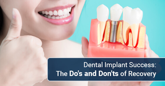 Dental Implant Success: The Do's and Don'ts of Recovery